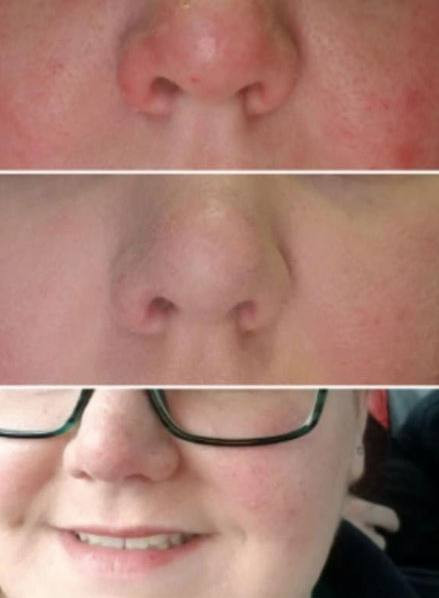 بالم ترمیم کننده پوست لاروش پوزای مدل CICAPLAST حجم 40 میل