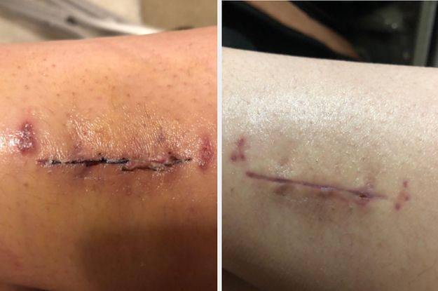 بالم ترمیم کننده پوست لاروش پوزای مدل CICAPLAST حجم 40 میل