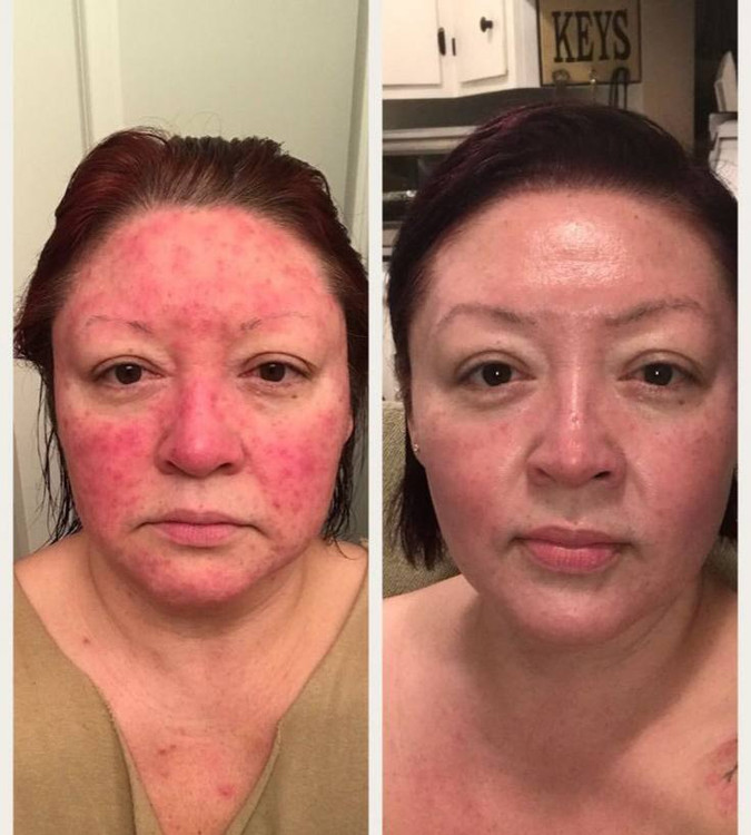 بالم ترمیم کننده پوست لاروش پوزای مدل CICAPLAST حجم 40 میل