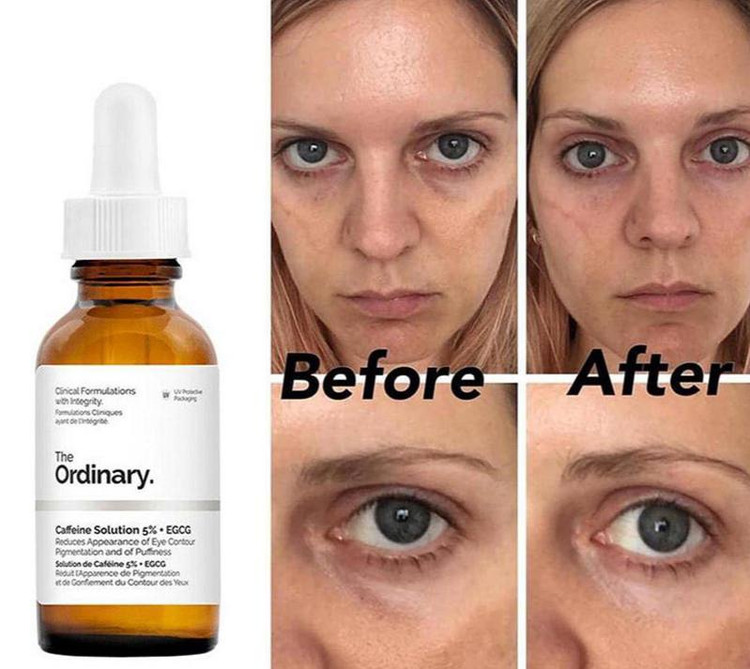 سرم دورچشم ضدتیرگی و پف کافئین اوردینری اصل حجم 30 میل