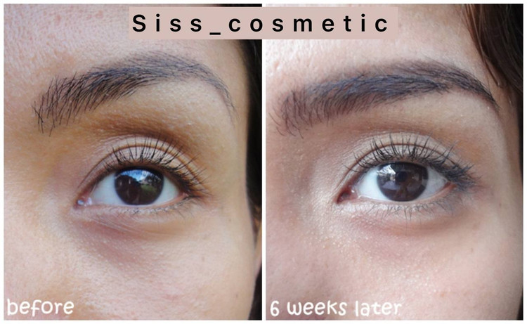 کرم دور چشم کلینیک آل ابوت آیز All About Eyesمدل تیوپی حجم 15 میل