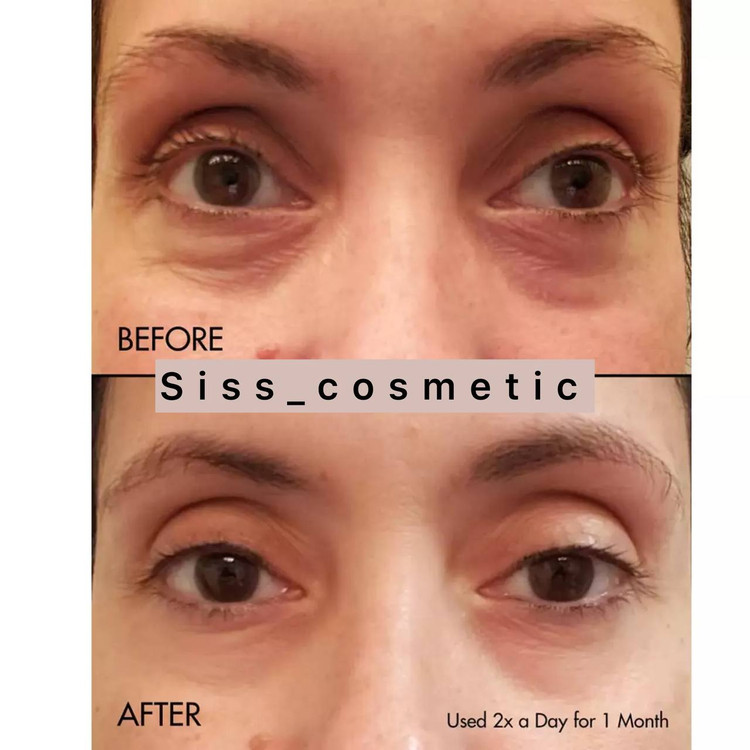 کرم دور چشم کلینیک آل ابوت آیز All About Eyesمدل تیوپی حجم 15 میل