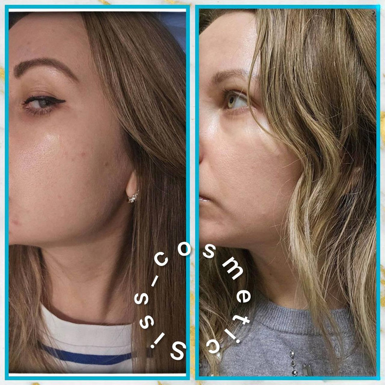 سرم نیاسینامید 10% + زینک 1% کاز دی باها حجم 60 میل