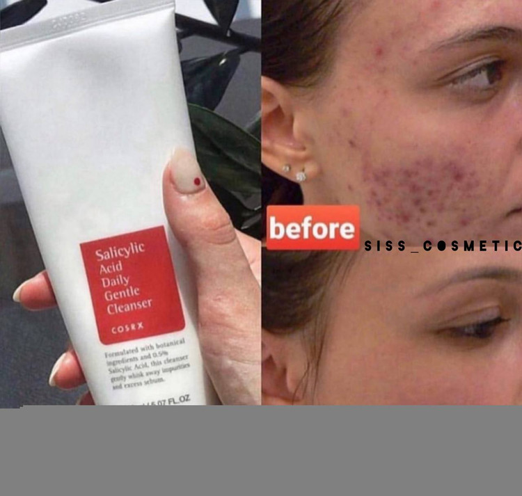 فوم شستشو صورت ملایم و روزانه سالیسیلیک اسید کوزارکس حجم150 میل