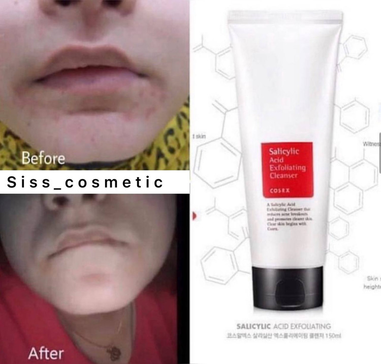 فوم شستشو صورت ملایم و روزانه سالیسیلیک اسید کوزارکس حجم150 میل