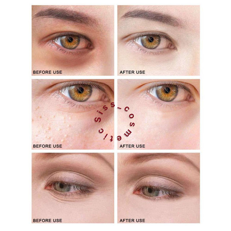 کرم دور چشم ضد چروک اسمارت کلینیک مدل Clinical Repair Wrinkle Correcting 15ML