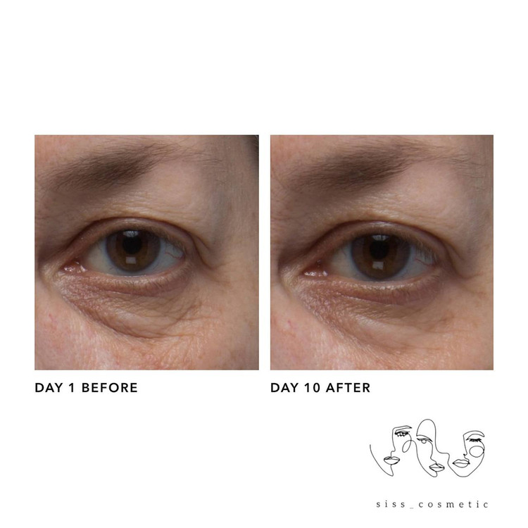 کرم دور چشم ضد چروک اسمارت کلینیک مدل Clinical Repair Wrinkle Correcting 15ML