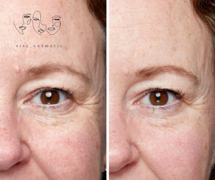 کرم دور چشم ضدپیری و ترمیم کننده استی لادر مدل revitalizing supreme youth power crème حجم 15 میل