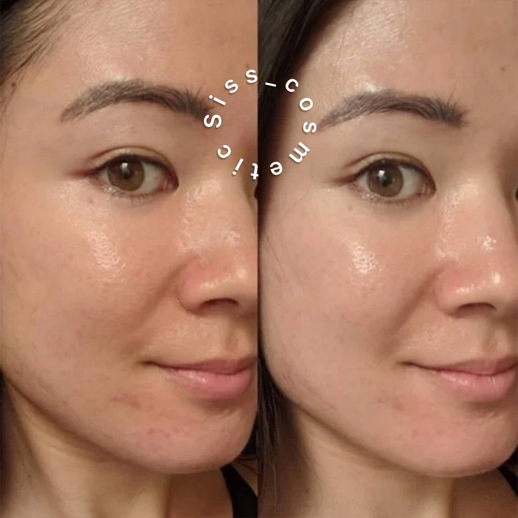 سرم ضدلک آربوتین نیاسینامید کاز دی باها حجم 30 میل