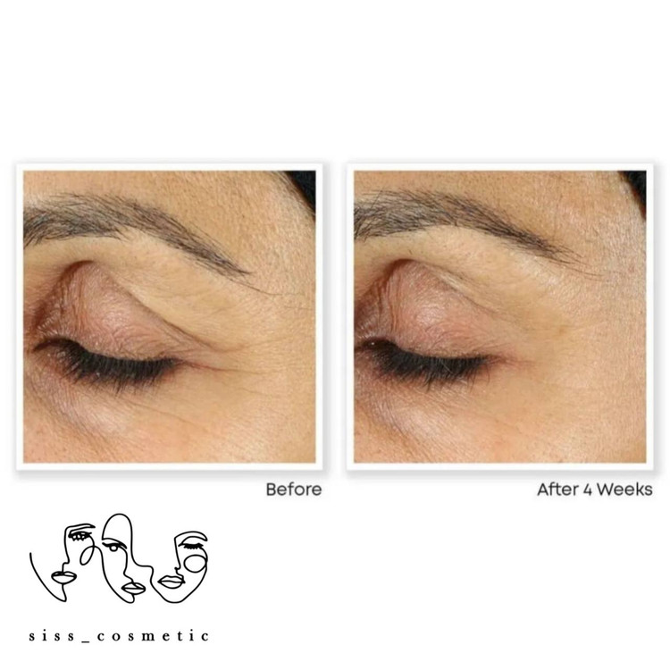 کرم دور چشم ضدچروک و پف رتینول روک حجم ١٧/٧ میل