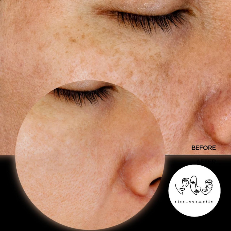 تونر گلایکولیک اسید 7% اوردینری اکسفولیتینگ لایه بردار و روشن کننده پوست حجم100 میل