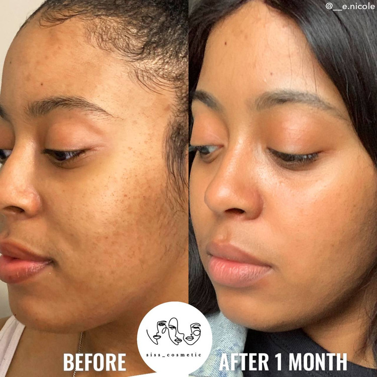 تونر گلایکولیک اسید 7% اوردینری اکسفولیتینگ لایه بردار و روشن کننده پوست حجم100 میل