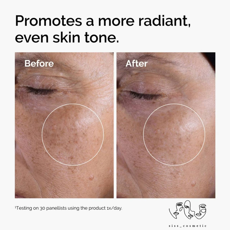 تونر گلایکولیک اسید 7% اوردینری اکسفولیتینگ لایه بردار و روشن کننده پوست حجم100 میل