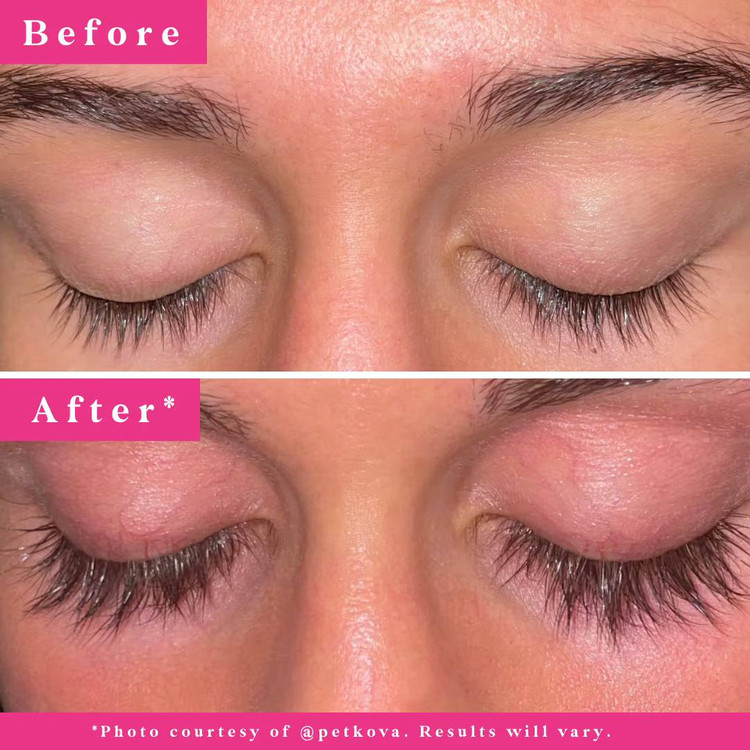 سرم تقویت کننده مژه گرندلش مدلGrande LASH-MD حجم2میل