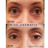 کرم دور چشم کلینیک آل ابوت آیز All About Eyesمدل کاسەای حجم 15میل