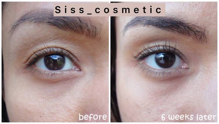 کرم دور چشم کلینیک آل ابوت آیز All About Eyesمدل کاسەای حجم 15میل